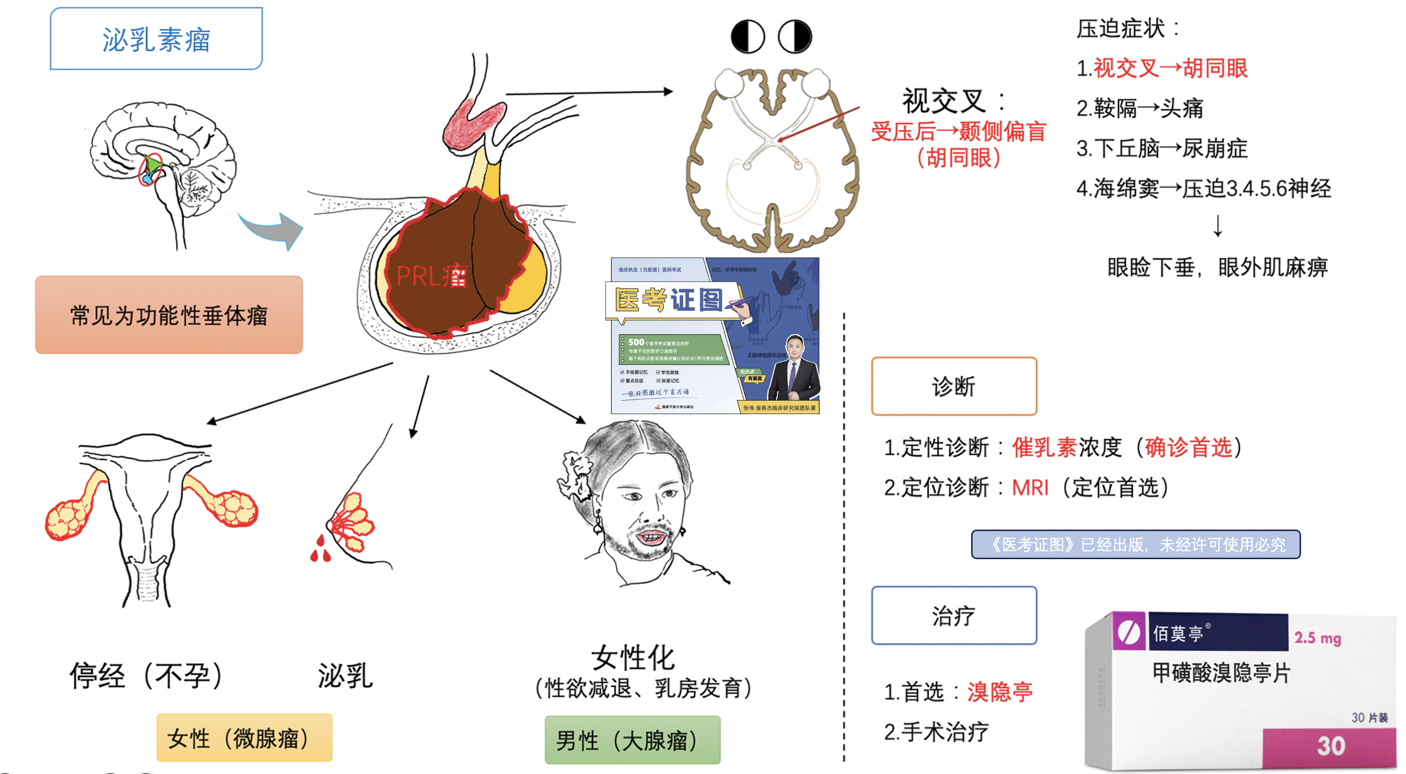 泌乳素瘤.png